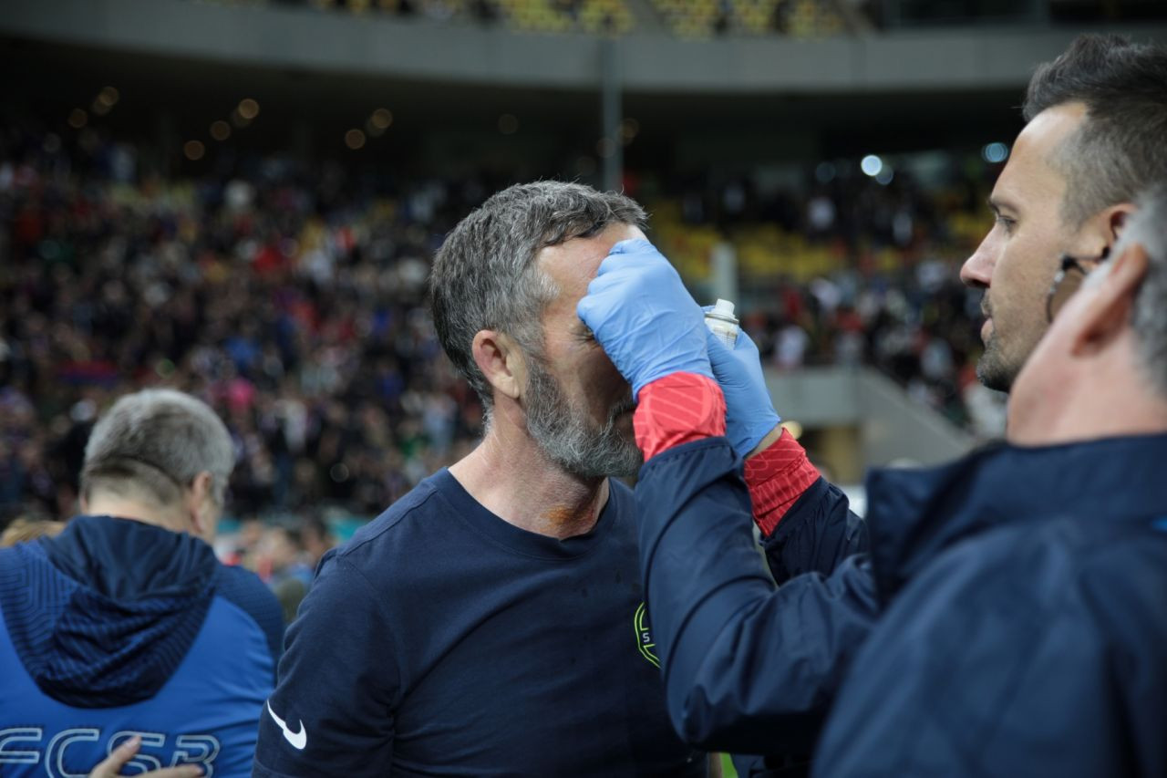 A comis-o! Mihai Stoica, plin de sânge la sărbătoarea de titlu a FCSB-ului! Un jucător al roș-albaștrilor i-a spart arcada_17