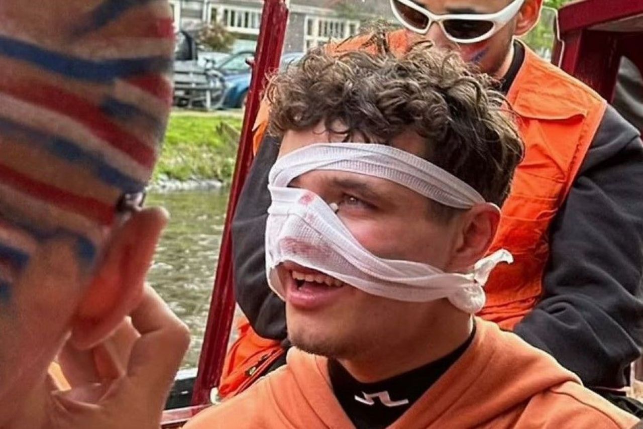 Lando Norris, rănit serios la față în Olanda! Starul din F1 petrecea cu DJ-ul Martin Garrix_1