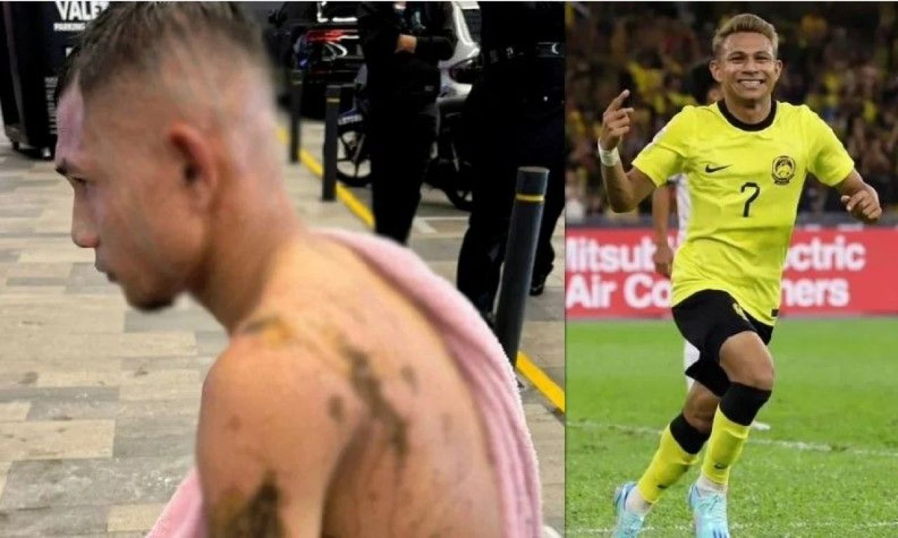 Teroare în Malaysia! Trei fotbaliști de națională atacați cu acid, răniți și amenințați cu moartea în ultimele zile_1