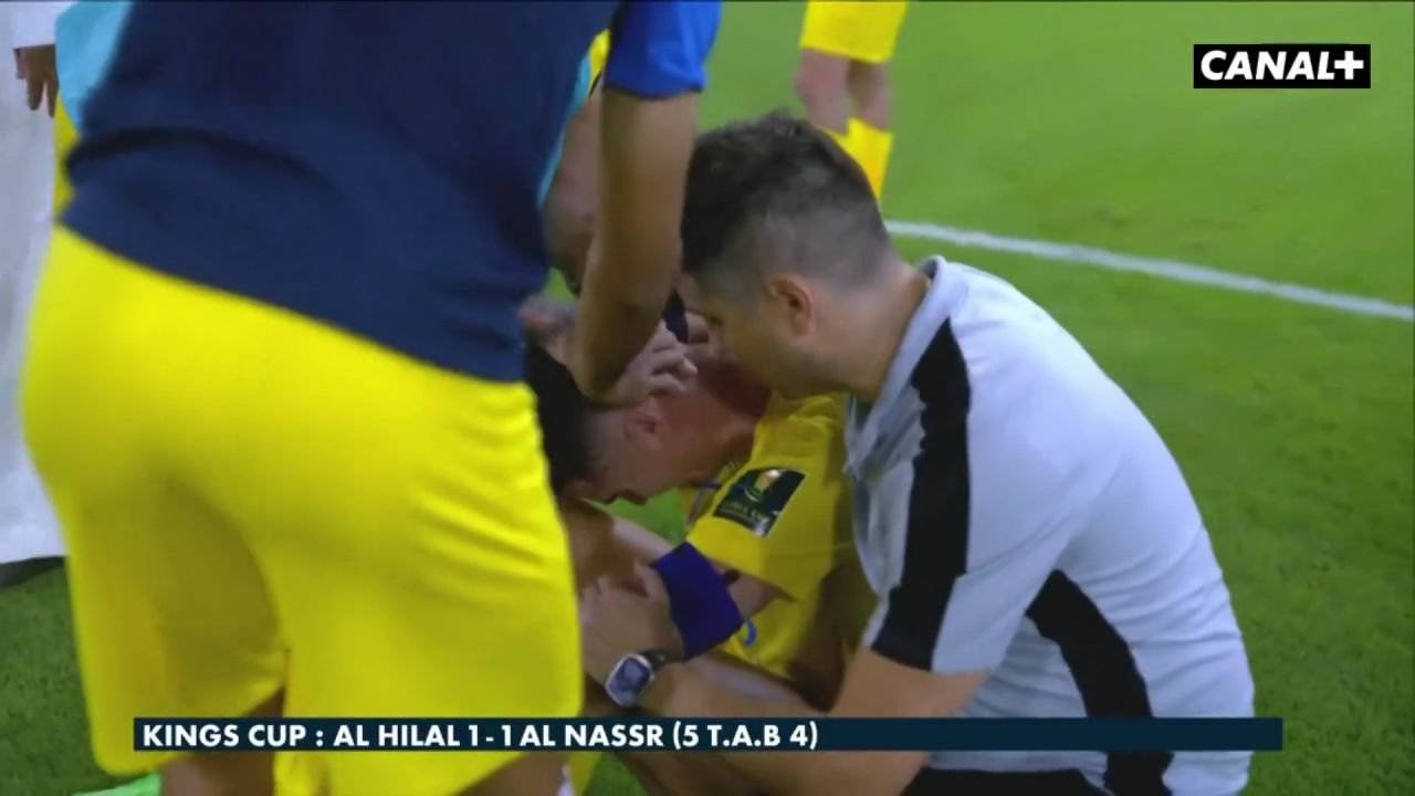 Cristiano Ronaldo, imposibil de consolat după un nou trofeu pierdut! Al Nassr a anunțat ce se întâmplă cu CR7_9