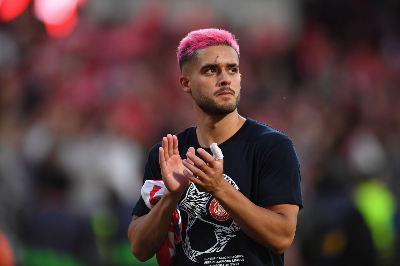 Lecție pentru Rațiu? Ce a pățit jucătorul Braziliei care s-a vopsit înainte de a merge la națională_4