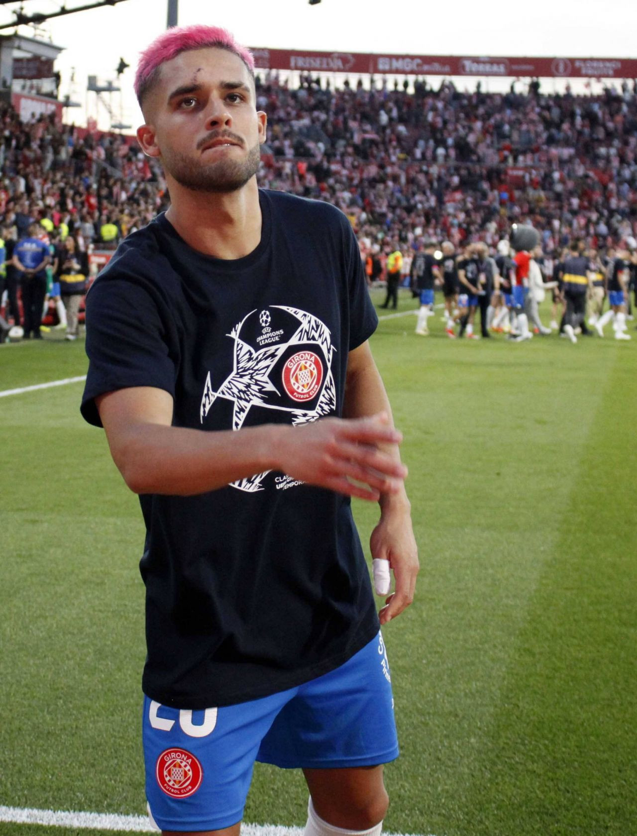 Lecție pentru Rațiu? Ce a pățit jucătorul Braziliei care s-a vopsit înainte de a merge la națională_5