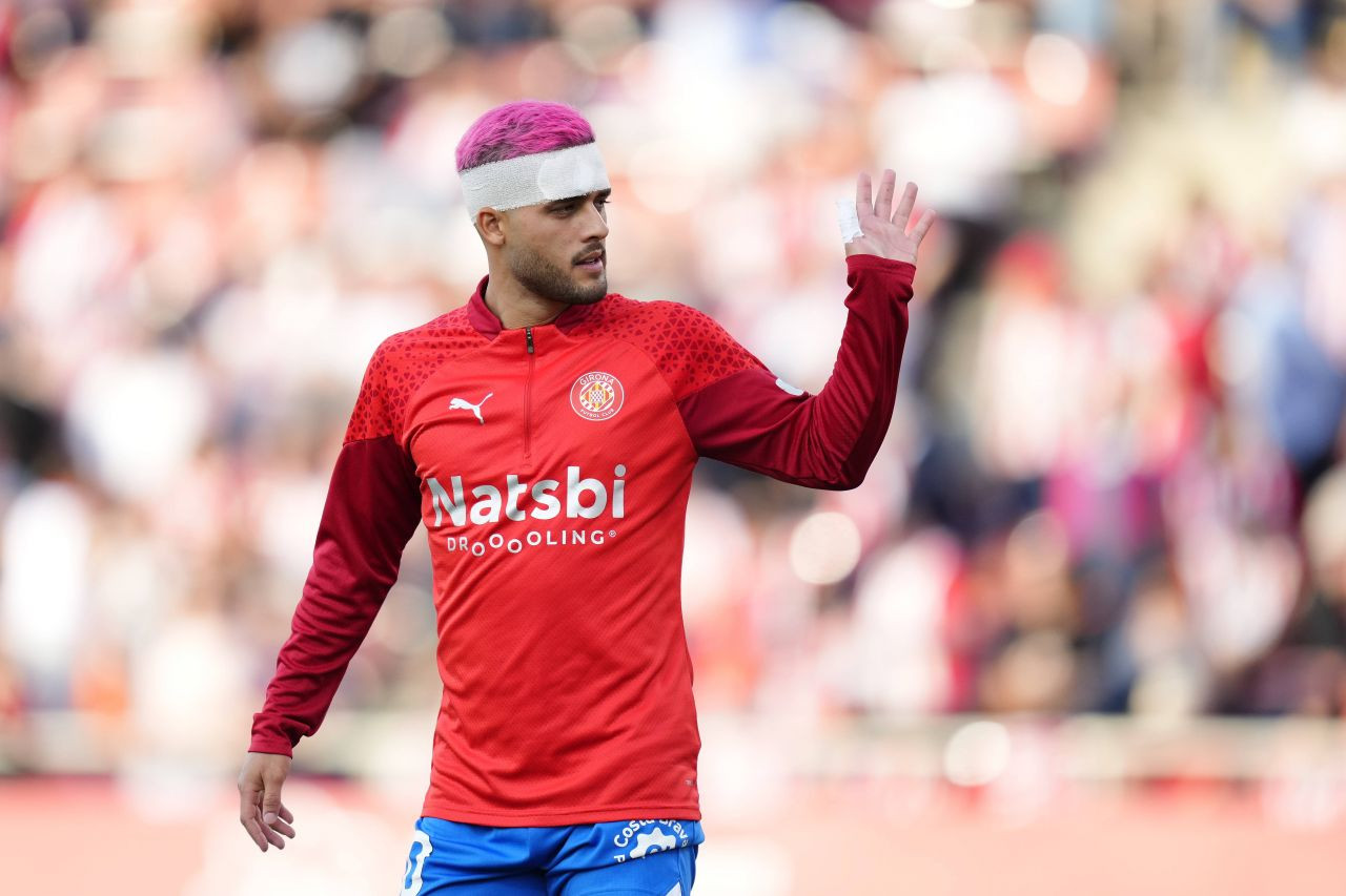 Lecție pentru Rațiu? Ce a pățit jucătorul Braziliei care s-a vopsit înainte de a merge la națională_7