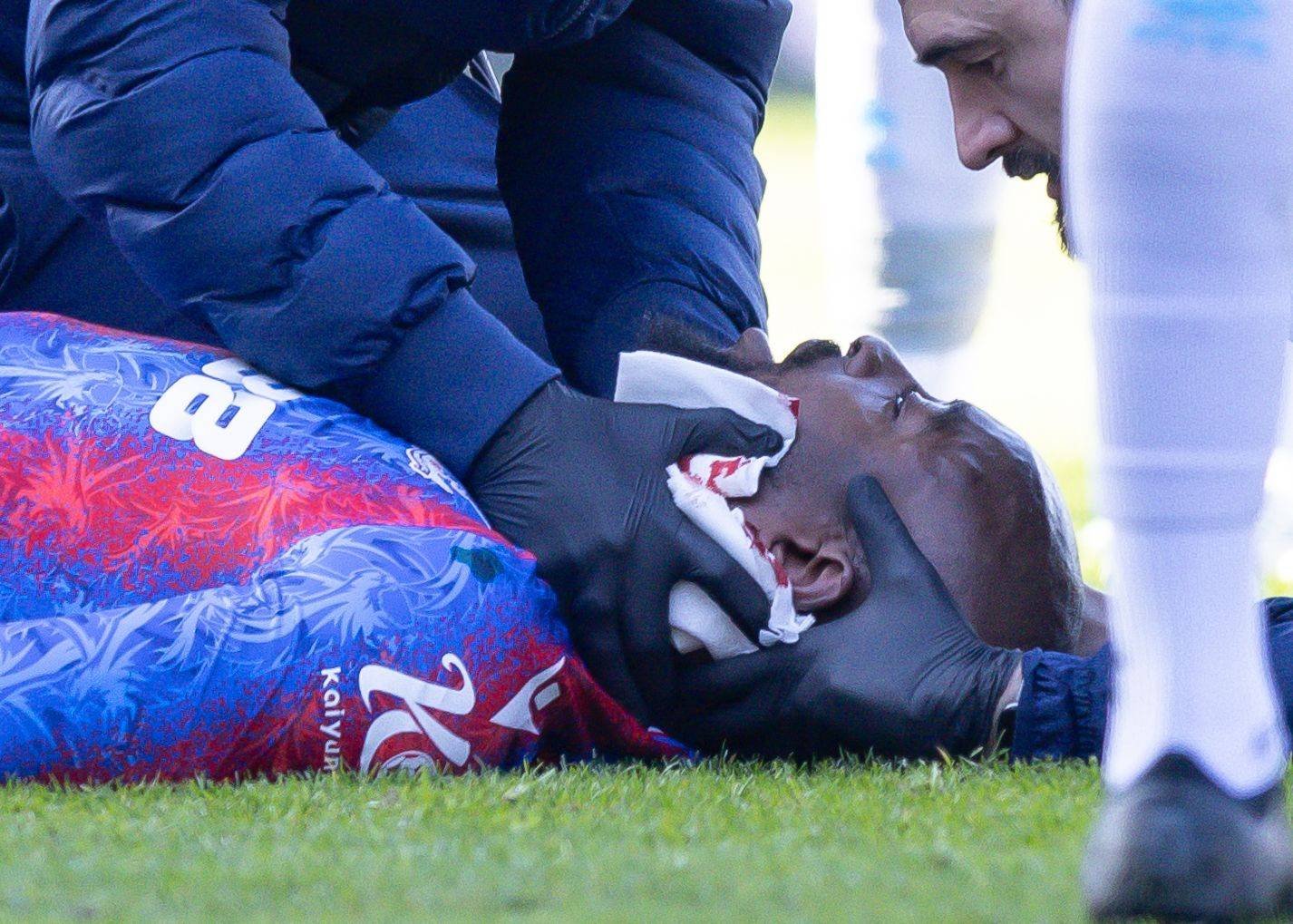&bdquo;Criminalul&ldquo; de la Millwall riscă o pedeapsă colosală: victima lui a avut nevoie de 25 de puncte de sutură