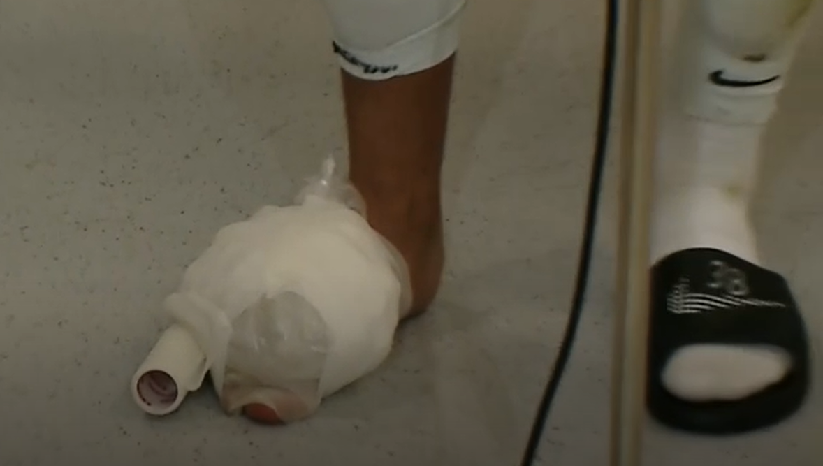 Imagini horror cu piciorul lui Mihai Lixandru. Cum a venit fotbalistul la flash-interviu