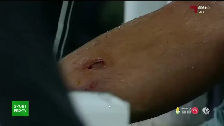 Accidentarea lui Coman, analizată la televiziunea din Qatar