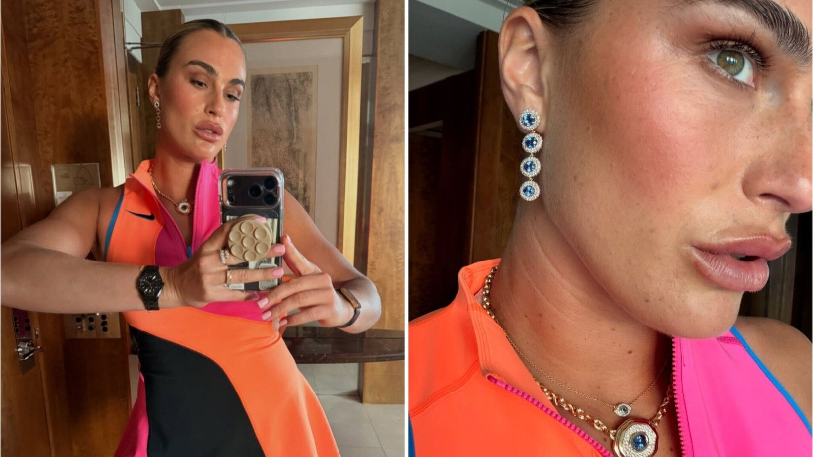 Sabalenka, în varianta „tunată“: Aryna și-a expus buzele botoxate la Australian Open