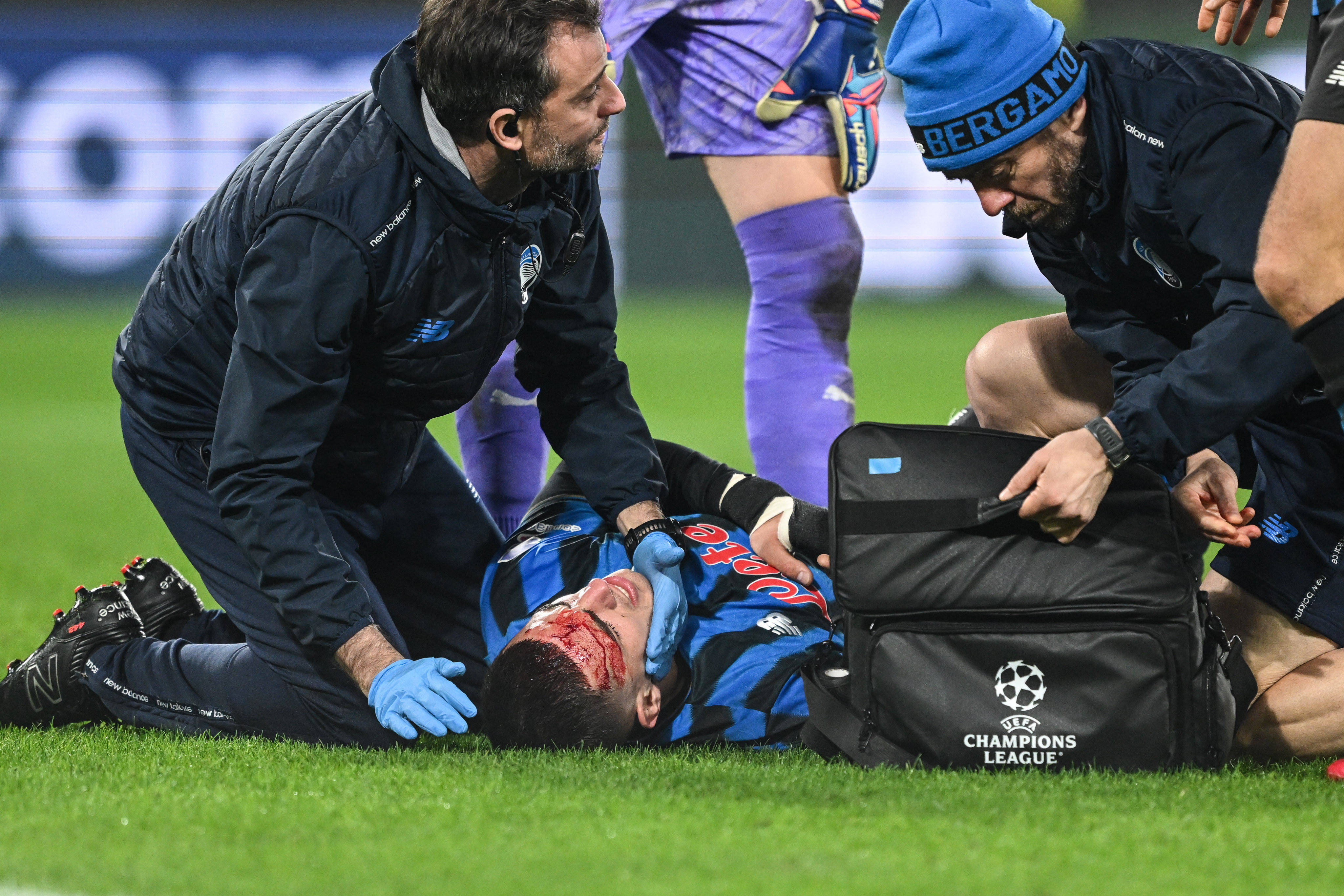 Incredibil! Cum arată jucătorul umplut de sânge în Champions League! A publicat imaginile pe internet