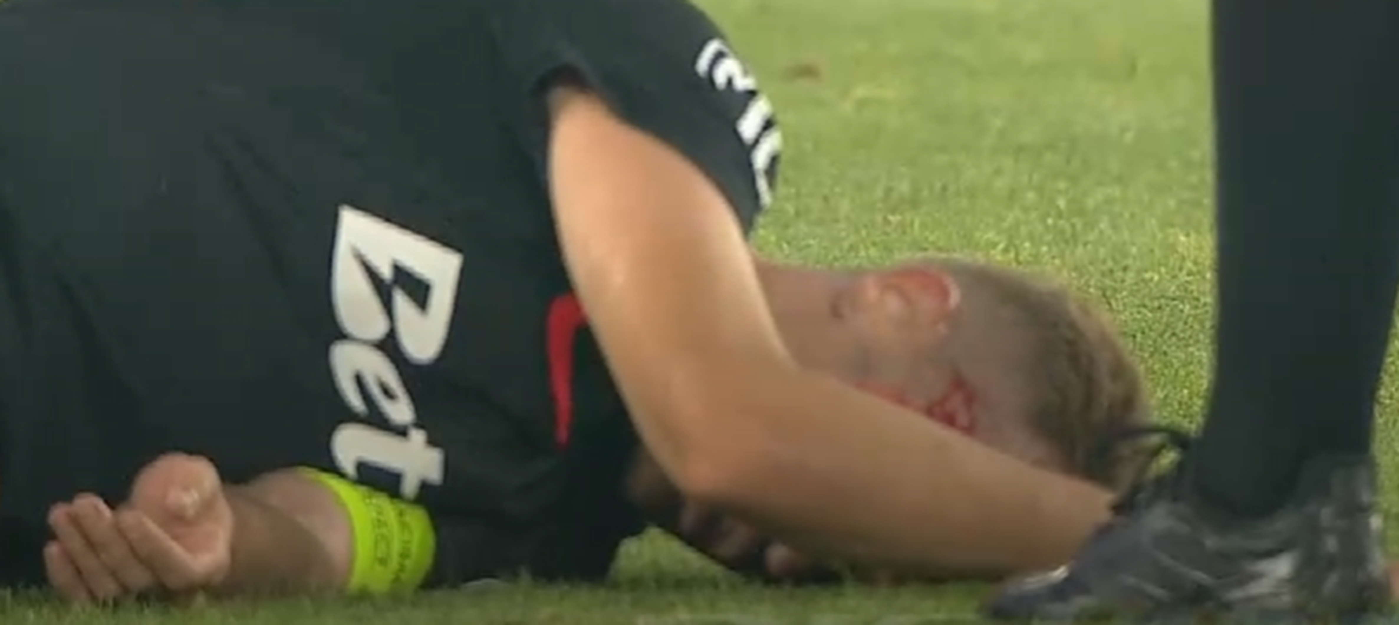 Darius Olaru, umplut de sânge în derby-ul cu Dinamo