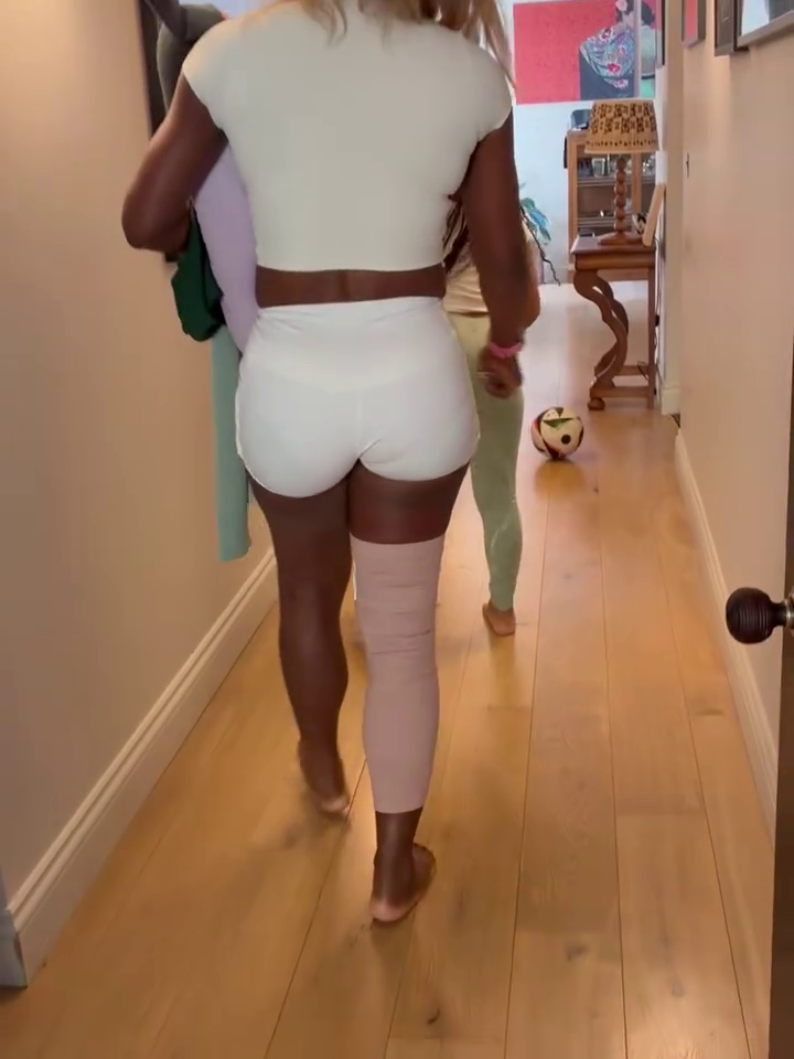 Serena williams accidentare 1