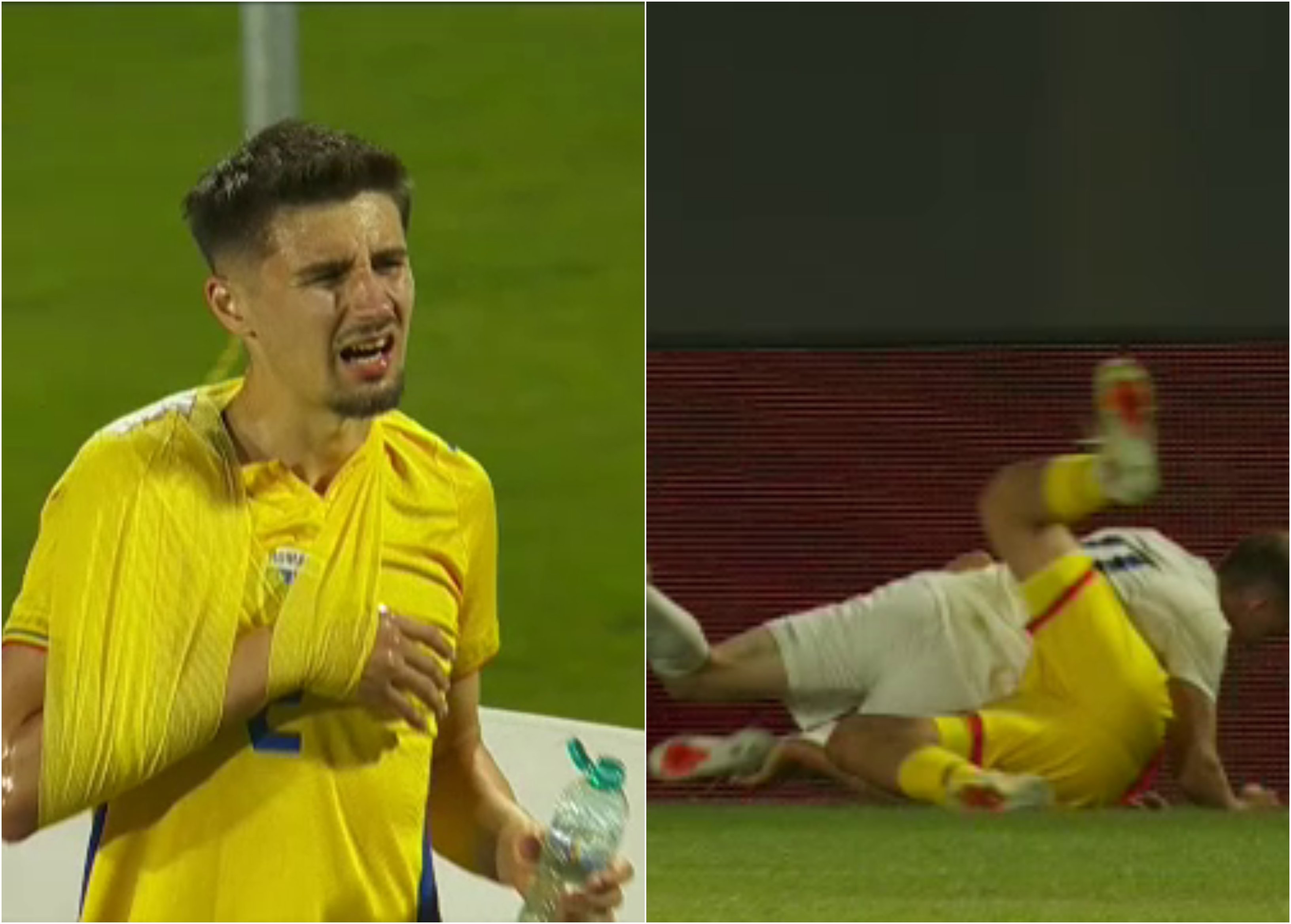 România U21 a pierdut un titular! A ieșit accidentat, cu mâna imobilizată